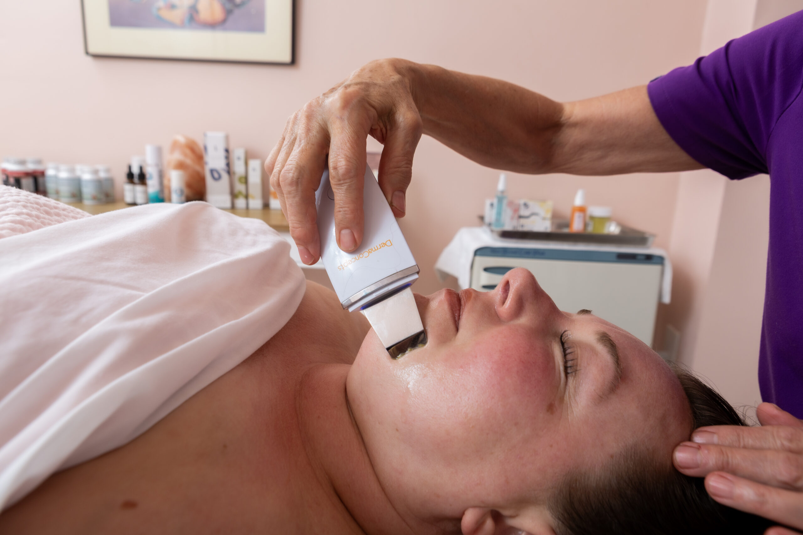 Microneedling Oceanside Ca